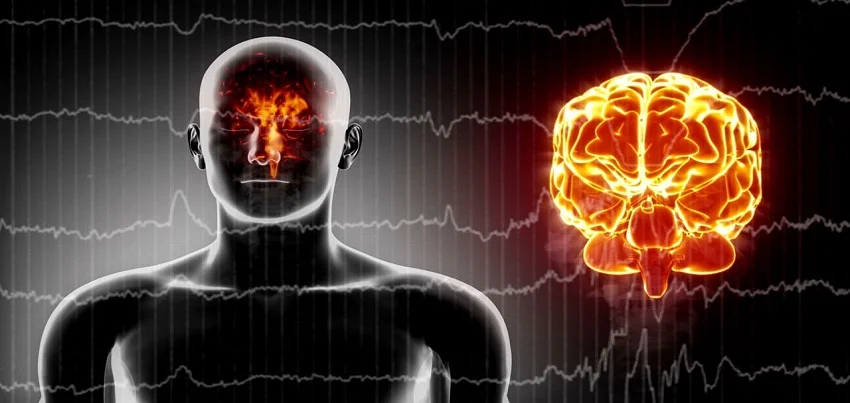 Electroencephalogram (EEG)