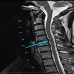 MRI of the neck