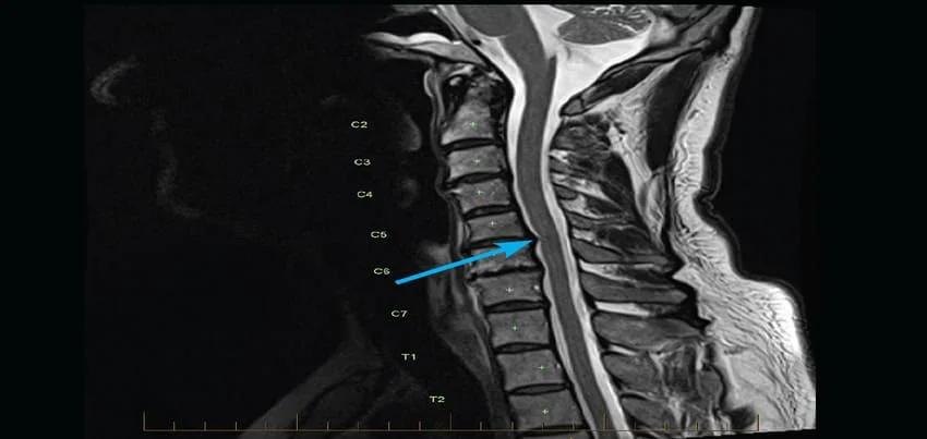 MRI of the neck