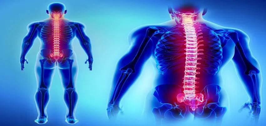 Spinal cord injury (SCI)