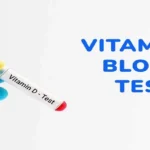 Vitamin D Test