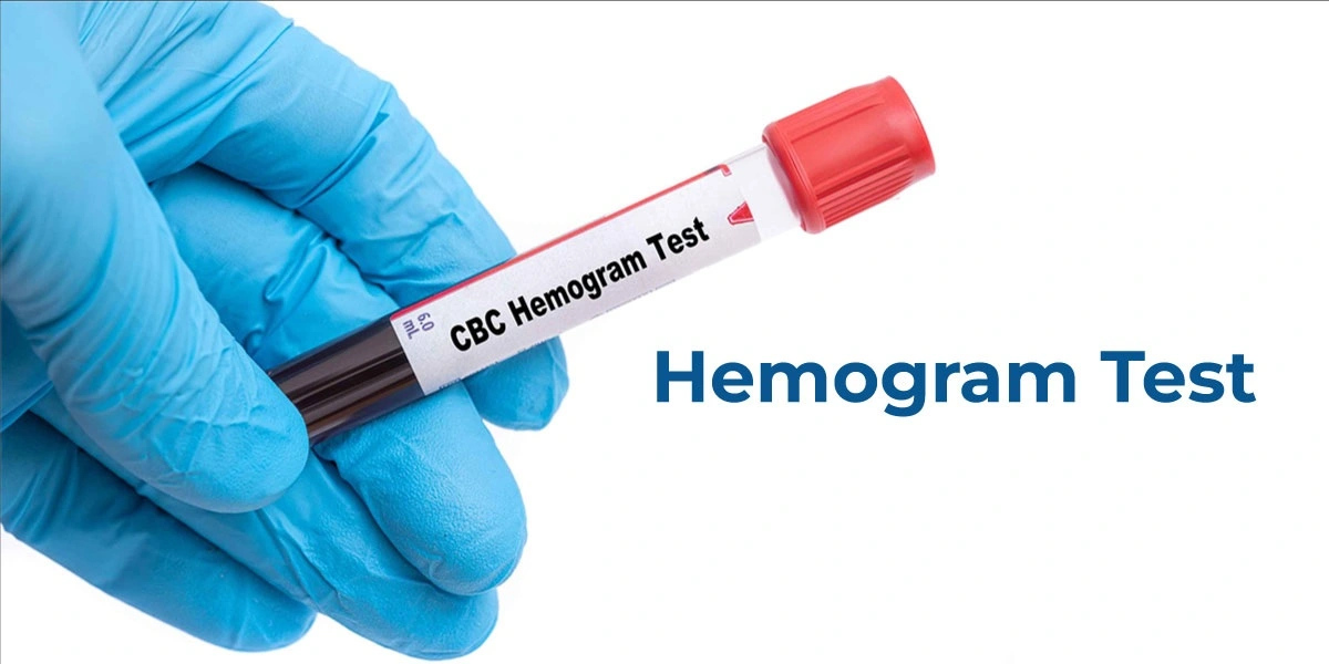 CBC / Hemogram